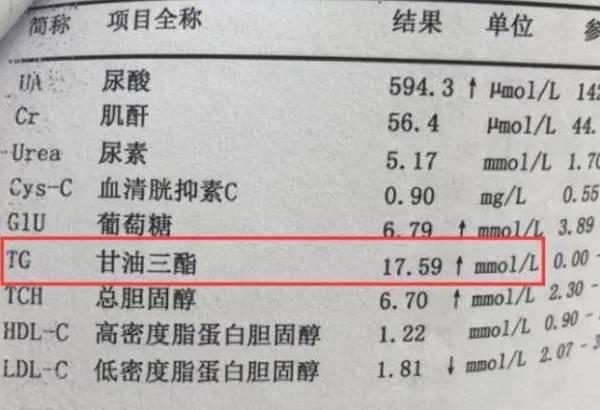 60至70岁甘油三酯值多少