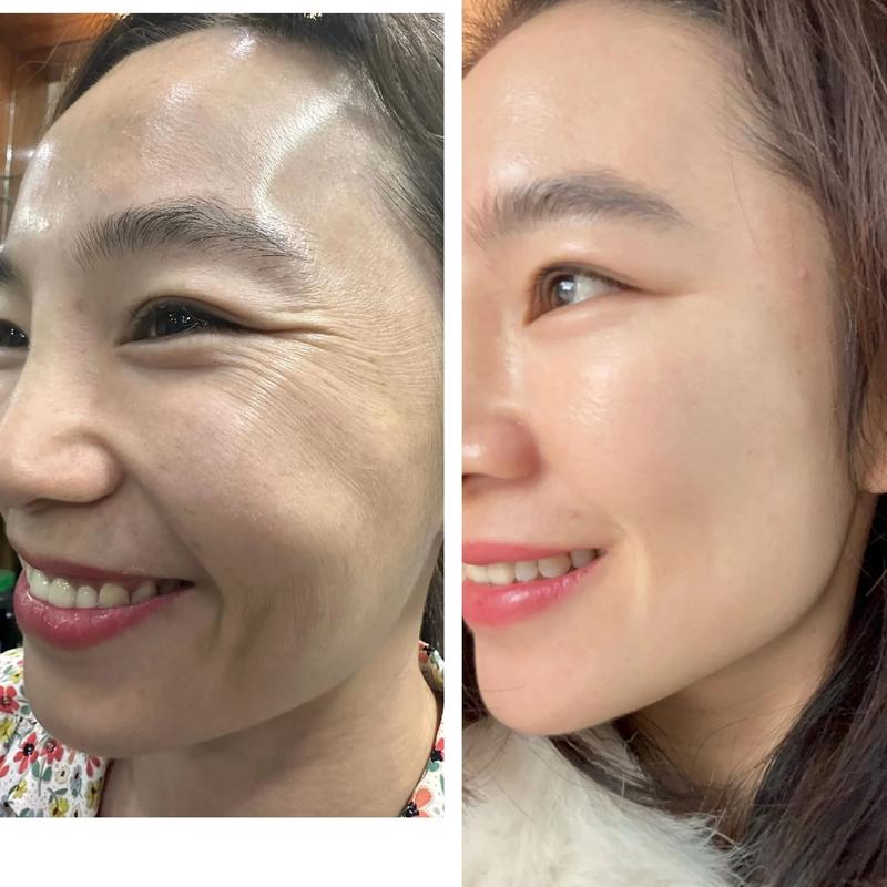 欧莱雅复颜抗皱紧致系列图标