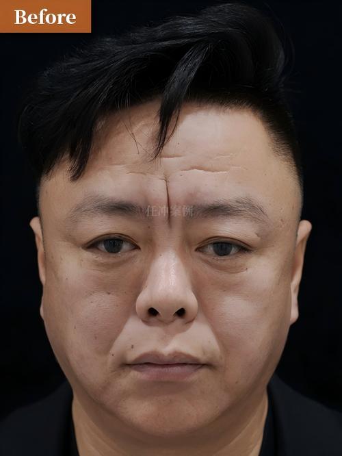 男人川字纹有什么说法