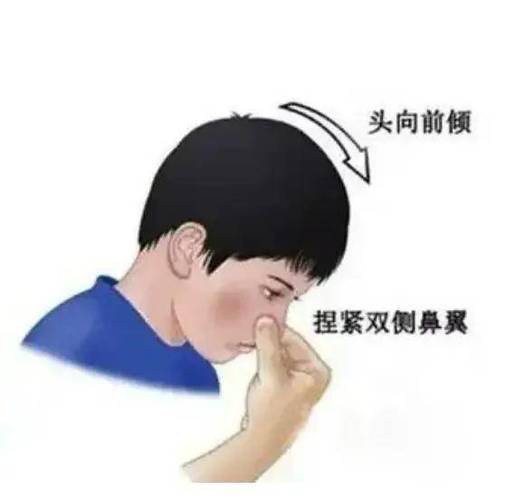 容易流鼻血是什么原因