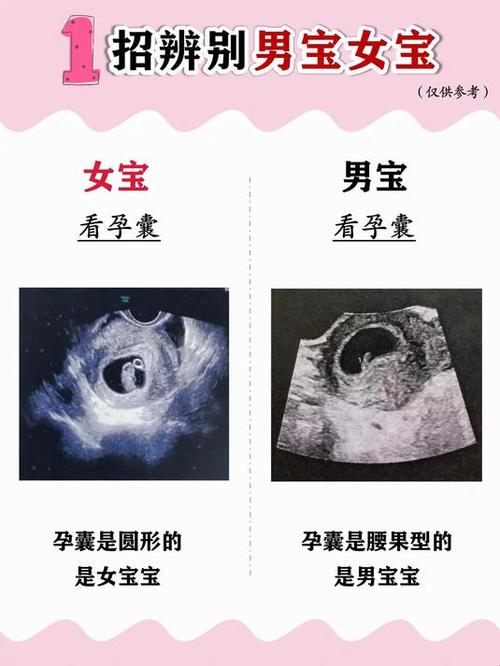 已生男宝的孕囊单子
