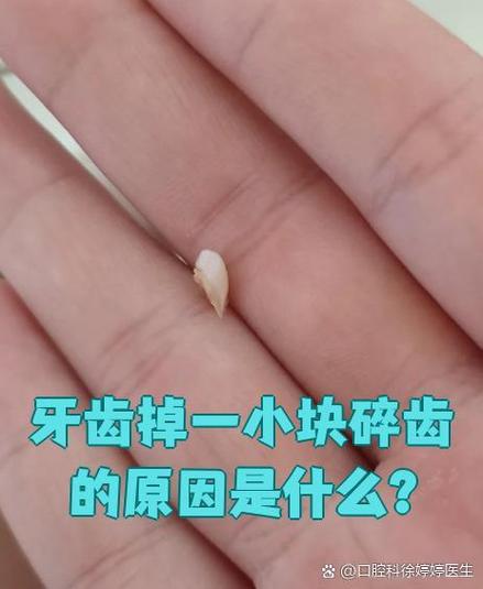 牙齿磕掉一小块会长吗