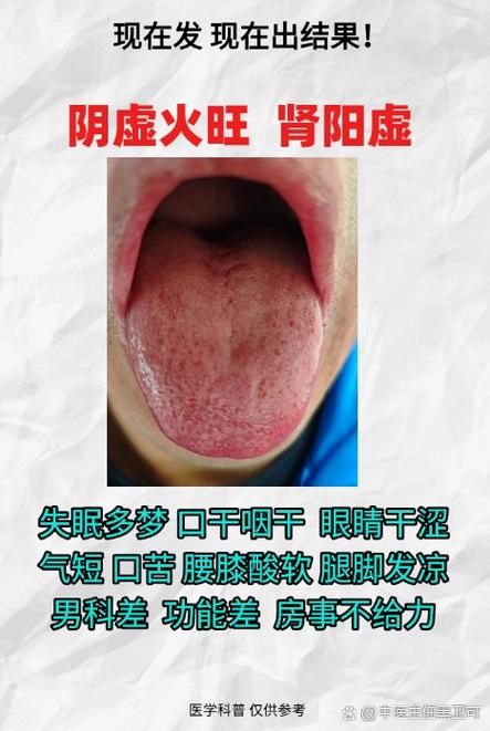 老花眼是肝火还是心火