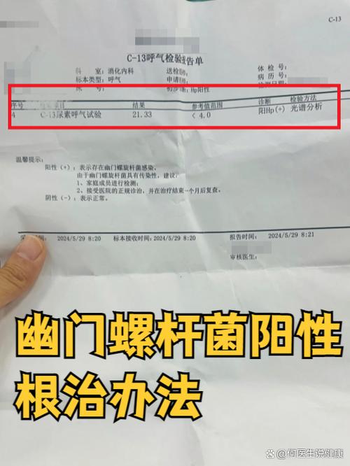 幽门螺杆菌阳性怎么治缩略图