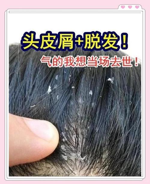 理发店做毁了我的头发