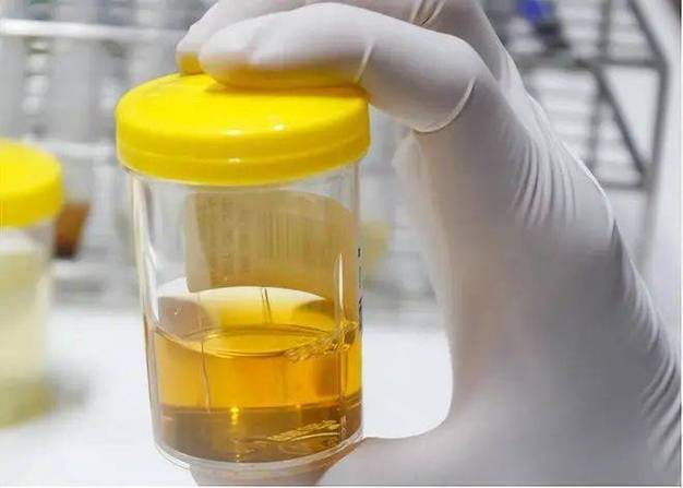 留24小时尿用什么容器