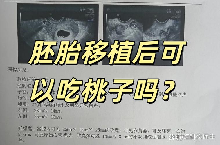 桃子移植loselife4.0怀孕版图标