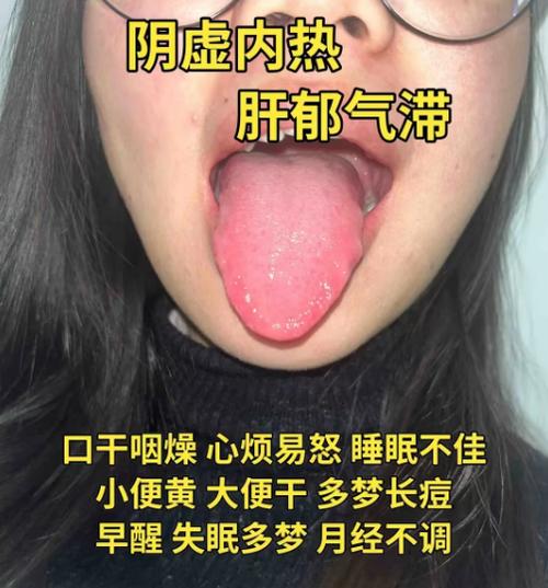 月经量少是什么原因