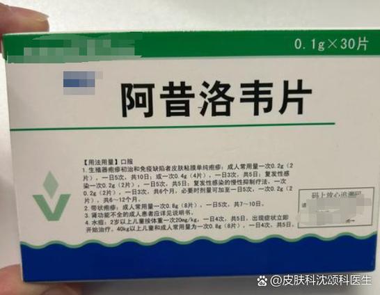 eb病毒用什么药治最好