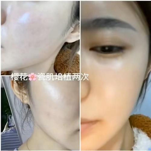 樱花水光瓷肌