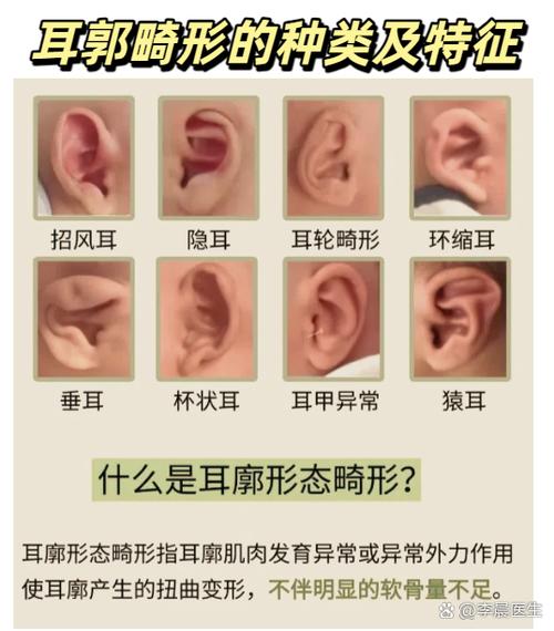 耳畸形的人是前世欠了什么