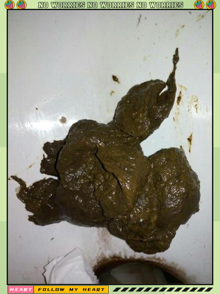 屎特别臭是什么原因