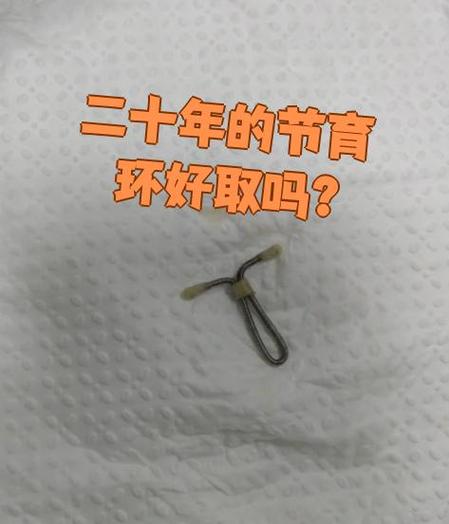 节育环20年还能取吗