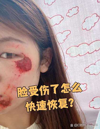 脸部受伤特效软件