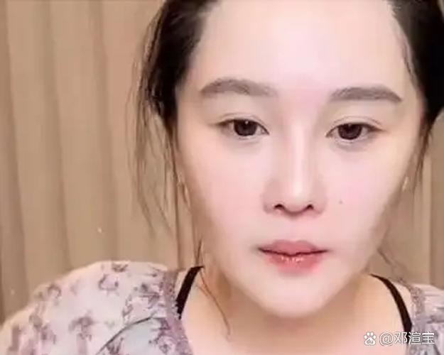 球球与白决红包