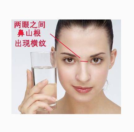 两个眼睛中间有横纹