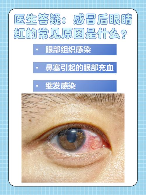眼睛看见红点绿点咋回事