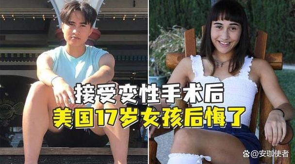 变性后永远只能乖乖蹲尿吗