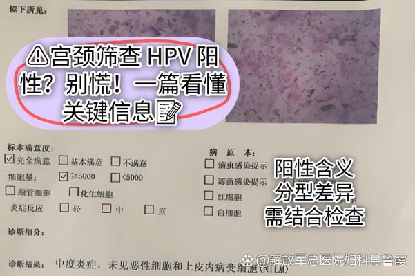 低危44阳性是什么原因