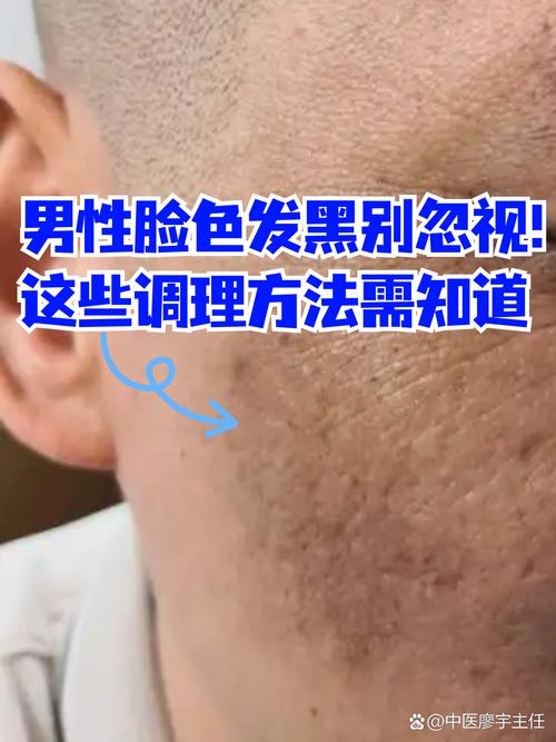 脸黑是身体哪里出问题了截图