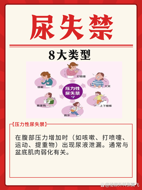 START—481尿失禁的病因分析