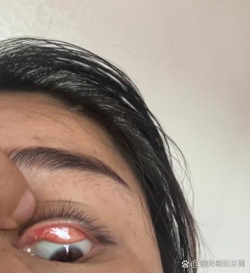 睫毛边上的一排小孔是什么