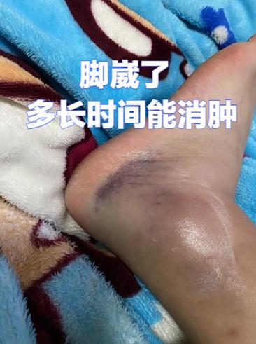 脚有伤口肿了怎么快速消肿