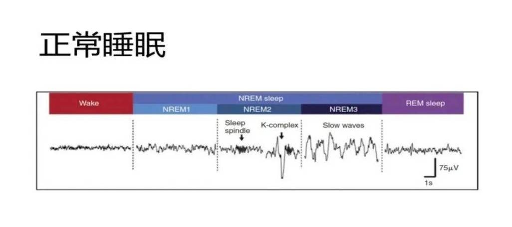 睡眠监测方法