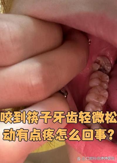 牙齿松动疼痛如何处理
