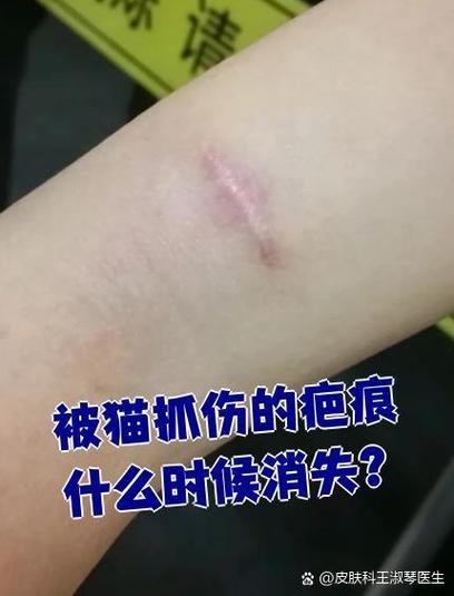 猫抓伤后印子多久消失