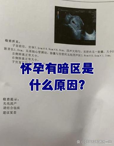 怀孕有暗区怎么办
