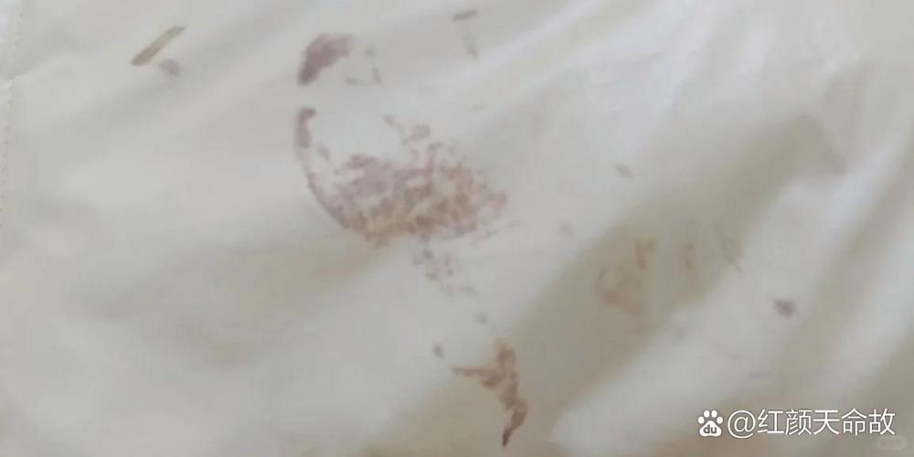 羽绒服挂着变颜色了怎么办