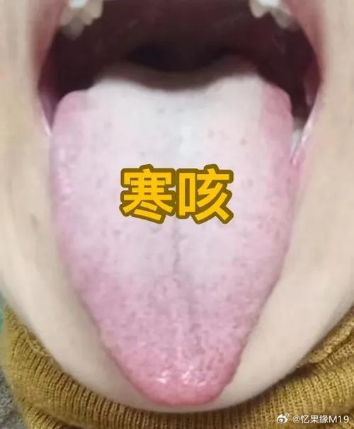 热咳和寒咳的区别晚上