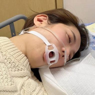 美女胃镜第一视角