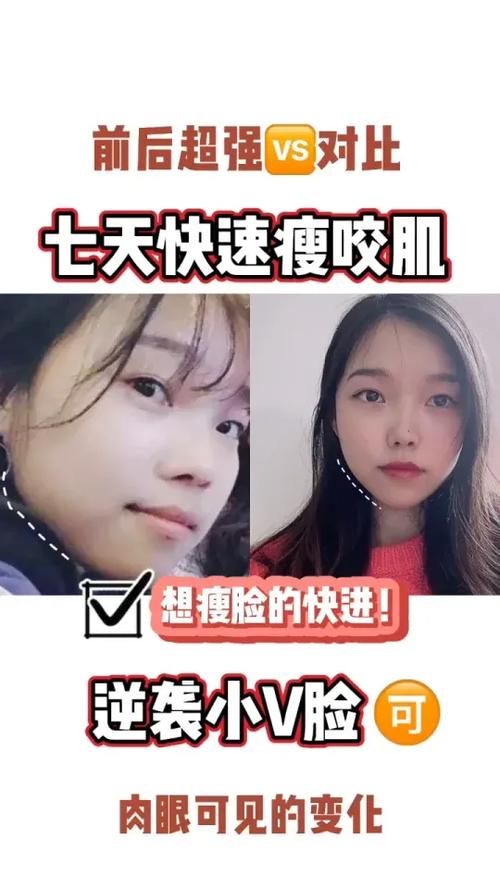 脸上咬肌大怎么瘦下来