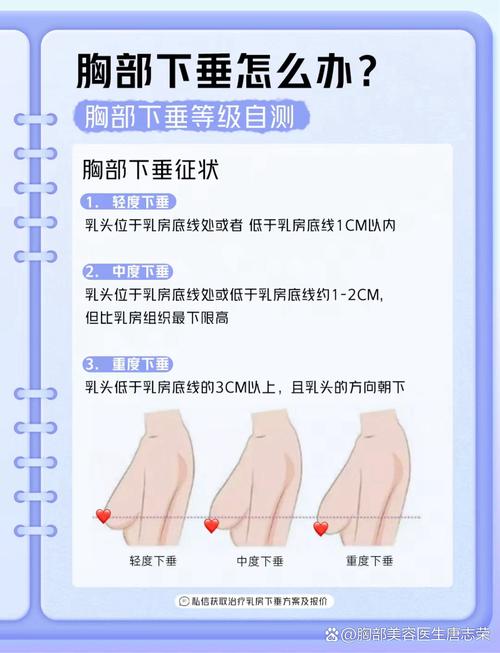 胸口佩戴式摄像头