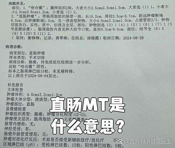 MT是什么意思