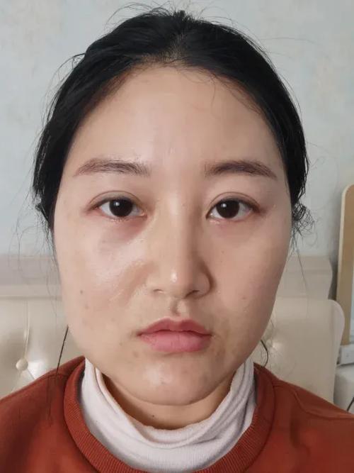 面部左右不对称图标