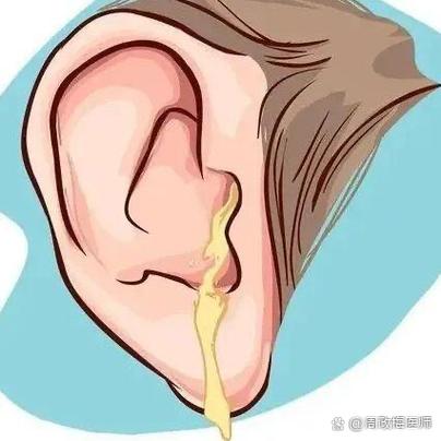 中耳炎拖久了会聋吗