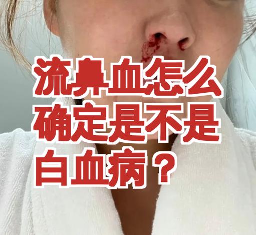 白血病除了流鼻血还有其他症状吗
