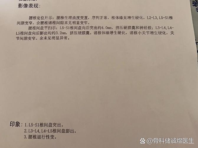 为什么不建议做融合手术