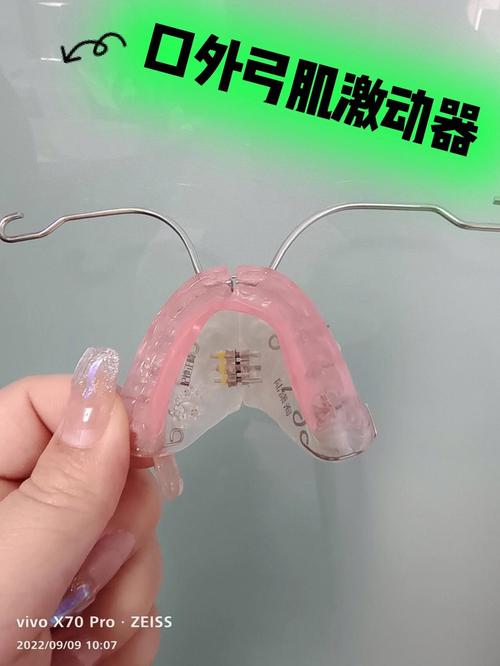 GusActivatorPRO真的能解开吗