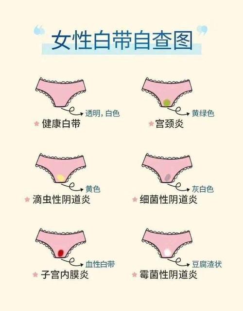 水状分泌物无异味怎么回事