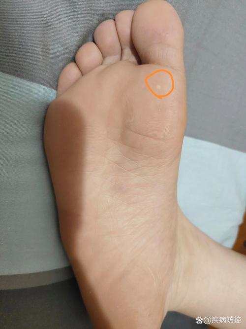 下面不够硬是什么原因引起的