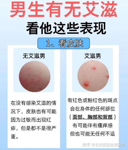 高危10天能不能检查出hiv