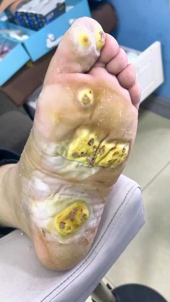 刷子刷警察脚底心视频