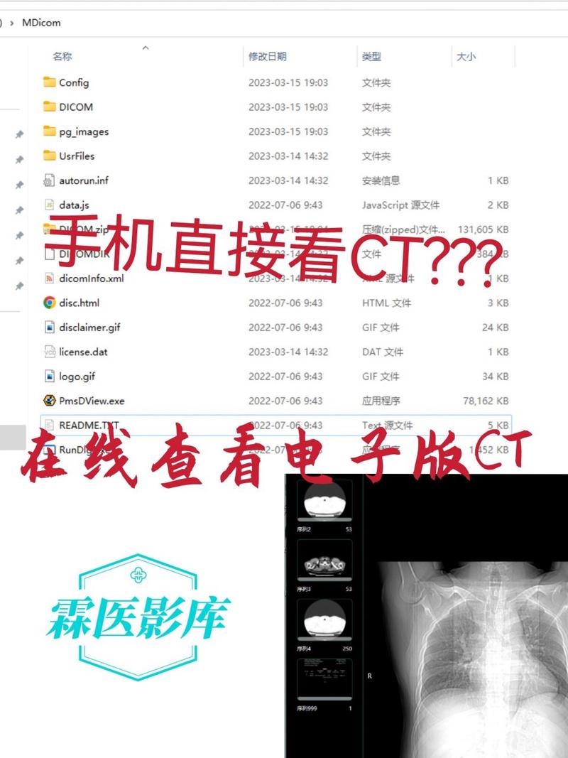 手机云影像ct怎么查看
