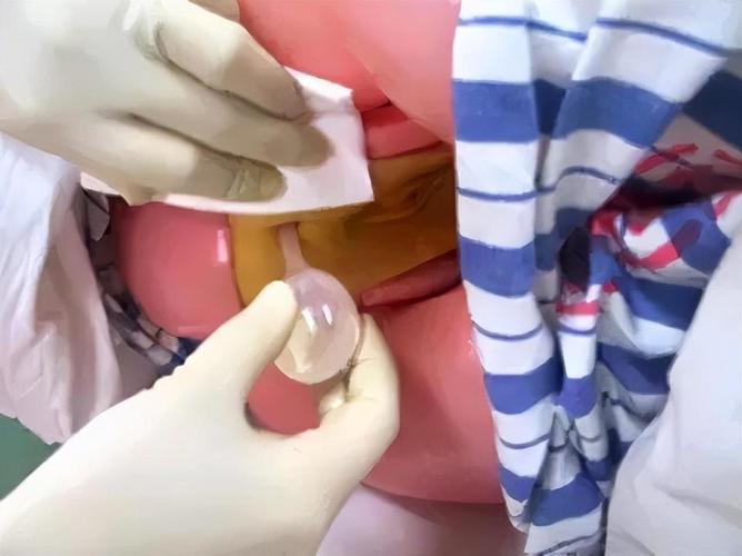 12岁小女孩肛门照片