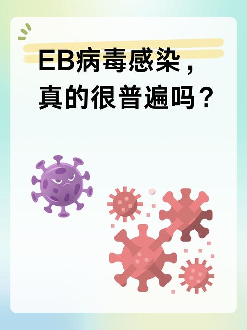 大人感染eb病毒怎么办