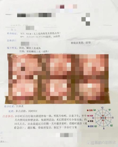 女子下体户型图片